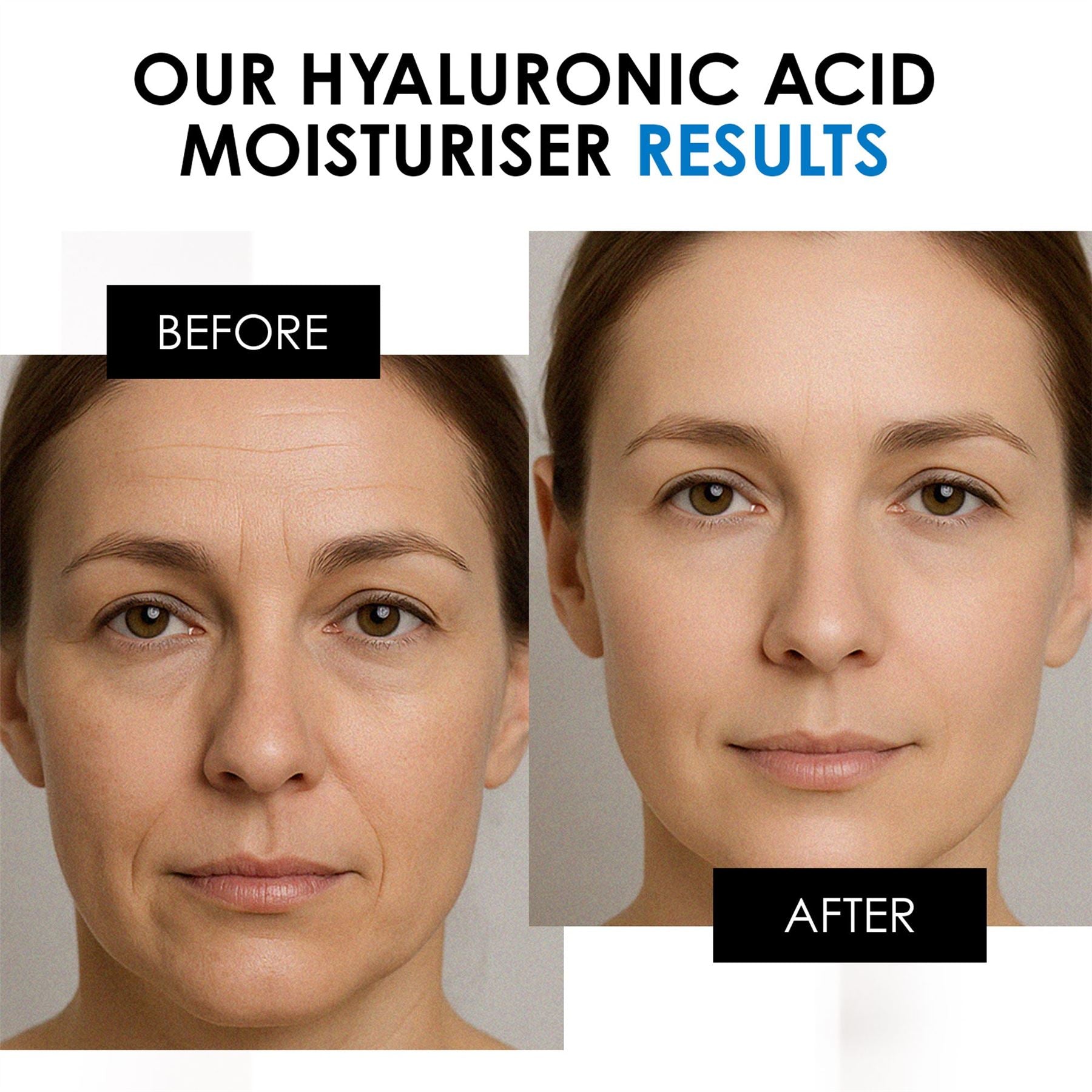 Hyaluronic Acid Day Moisturiser 50ml