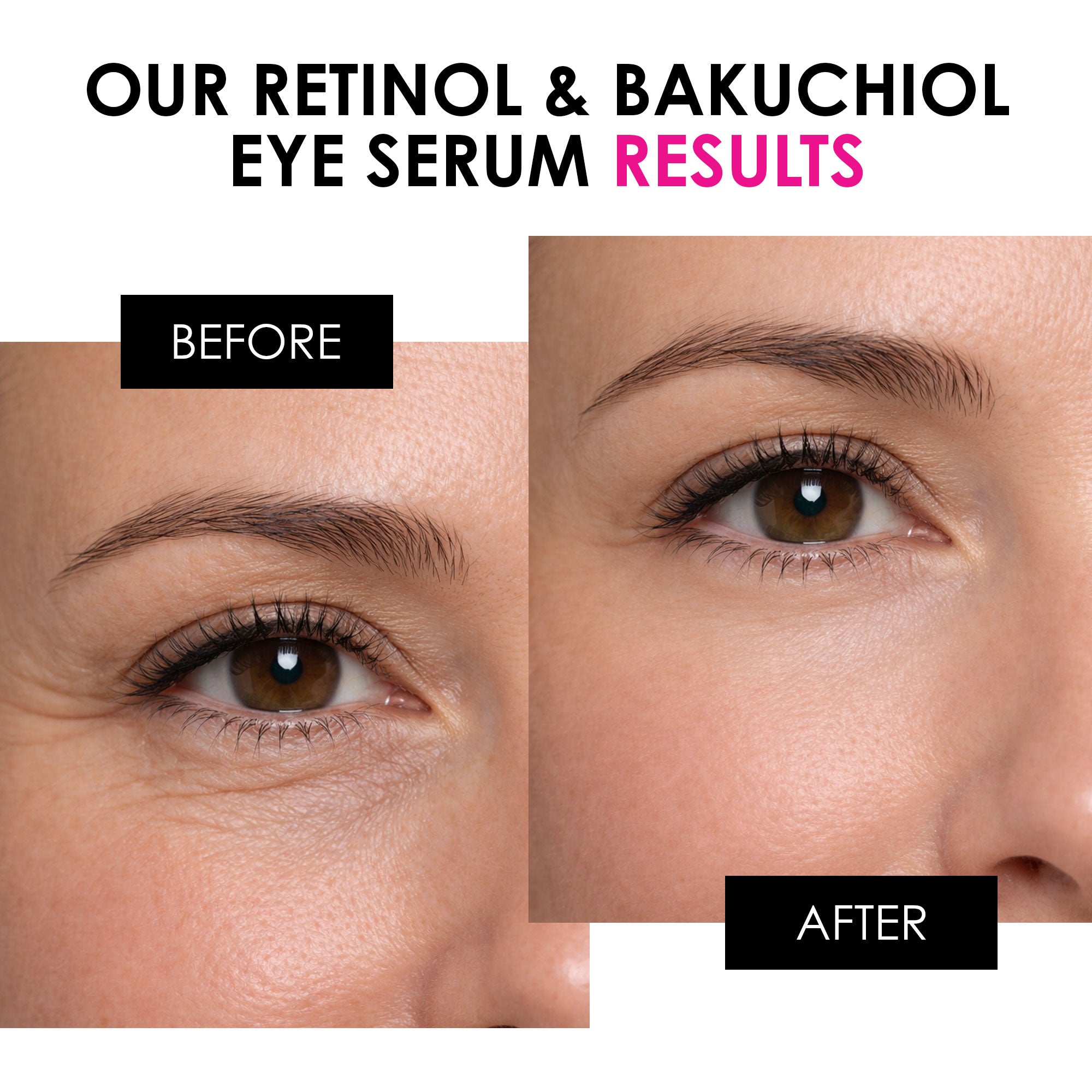 Retinol & Bakuchiol Eye Serum 15ml