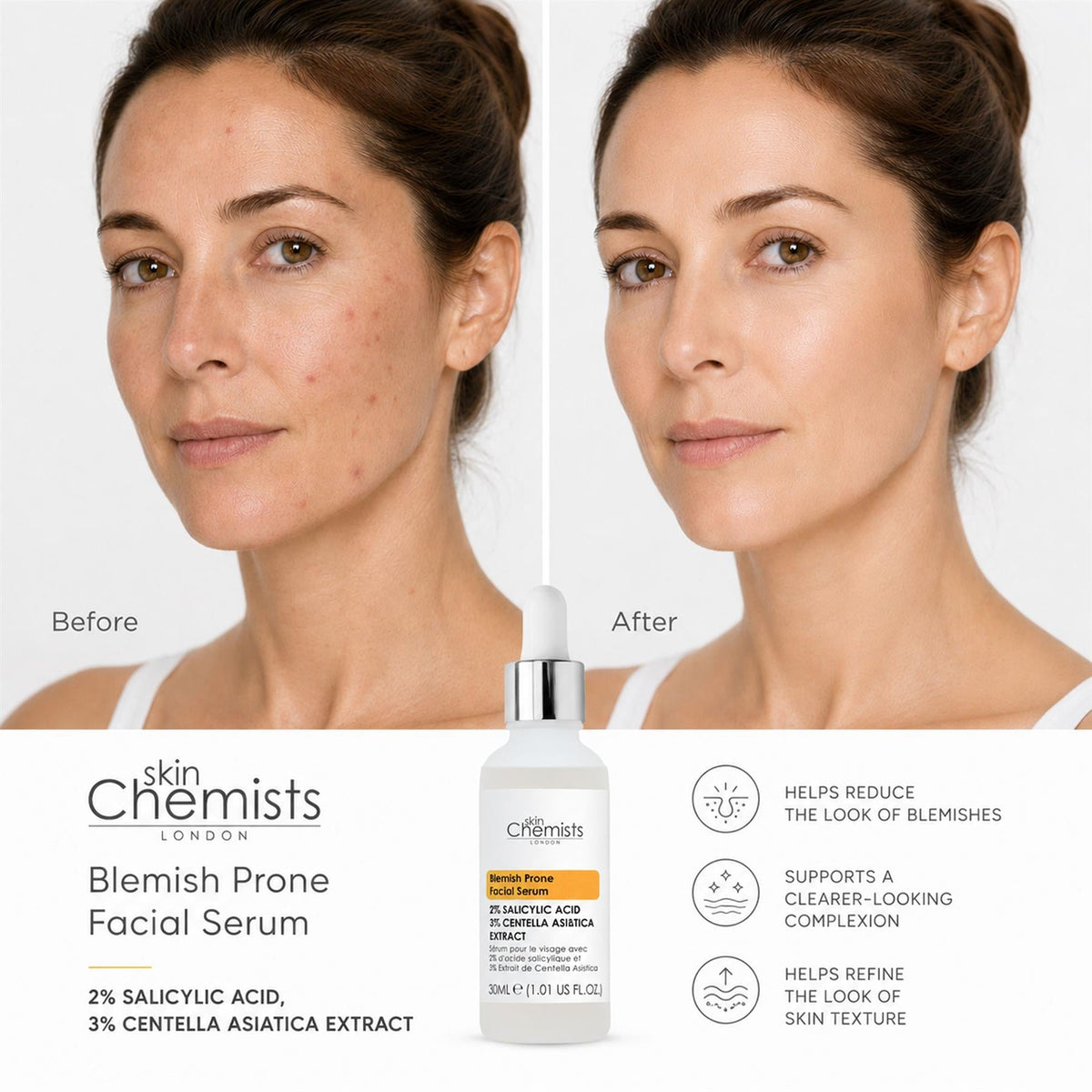 2% Salicylic Acid & 3% Centella Asiatica Blemish-Prone Facial Serum 30ml