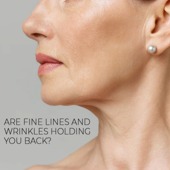 Understanding Fine Lines and Wrinkles