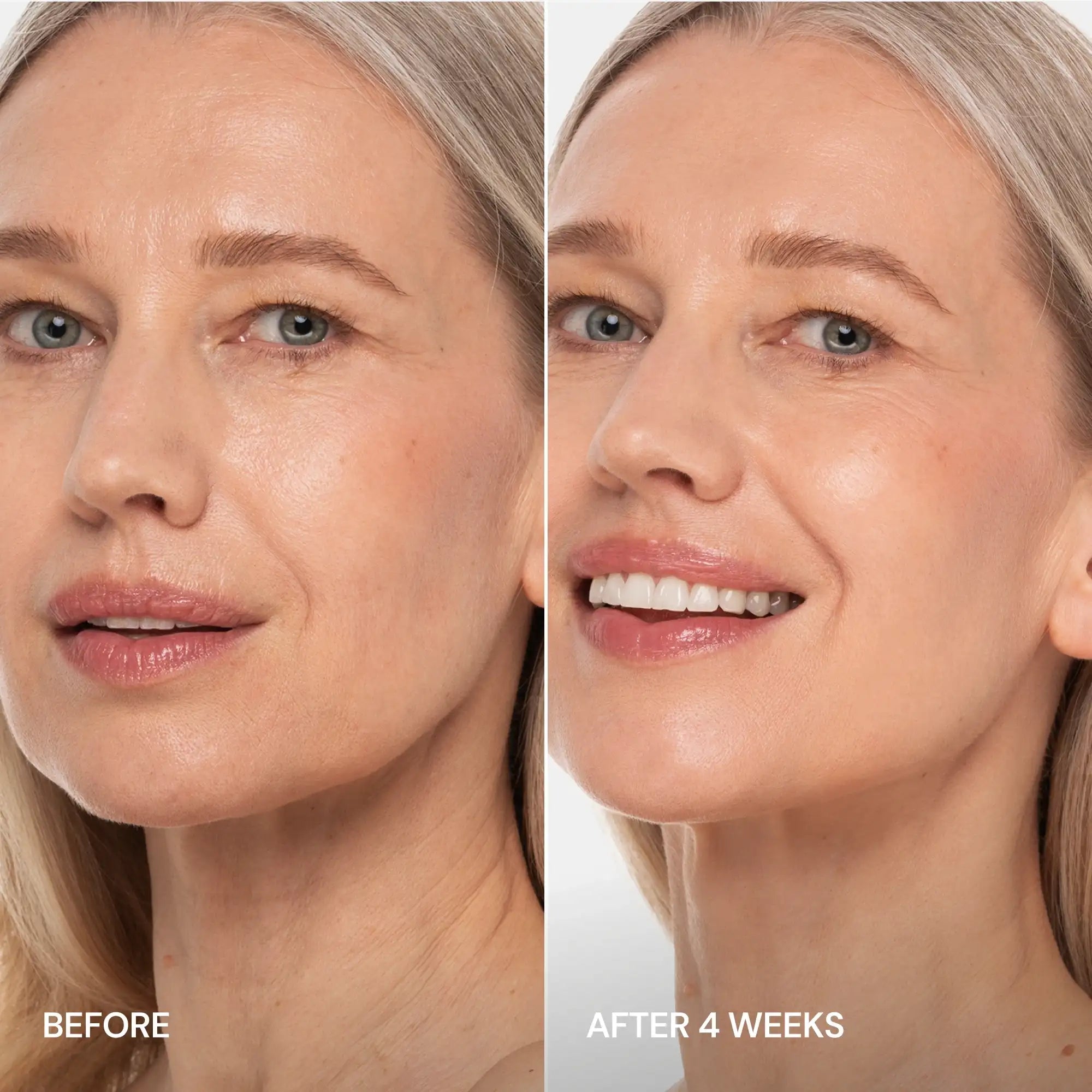 Pro-Retinol Neck Lifting Cream Massager