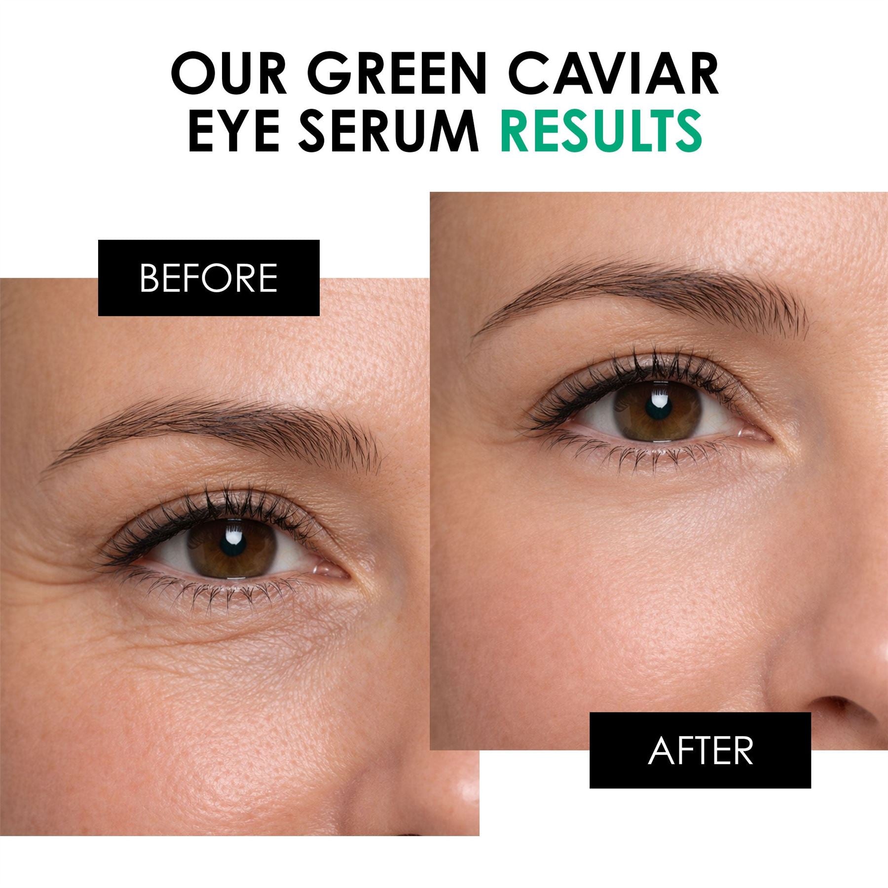 Green Caviar Eye Serum 15ml
